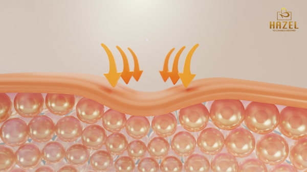 Collagen bị suy giảm